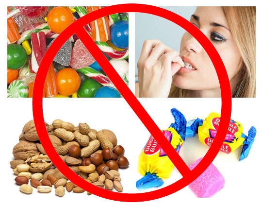 Chăm sóc răng miệng đúng cách trong suốt quá trình niềng răng Chăm sóc răng miệng đúng cách trong suốt quá trình niềng răng