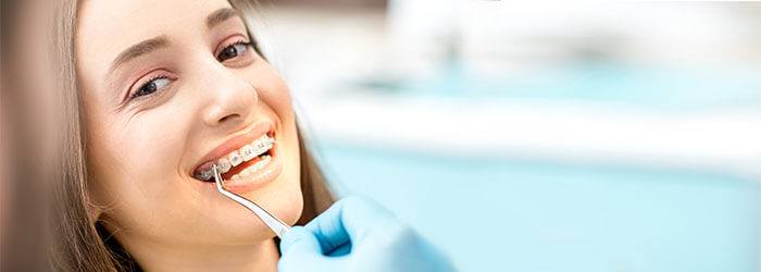 Chăm sóc răng miệng đúng cách trong suốt quá trình niềng răng Chăm sóc răng miệng đúng cách trong suốt quá trình niềng răng