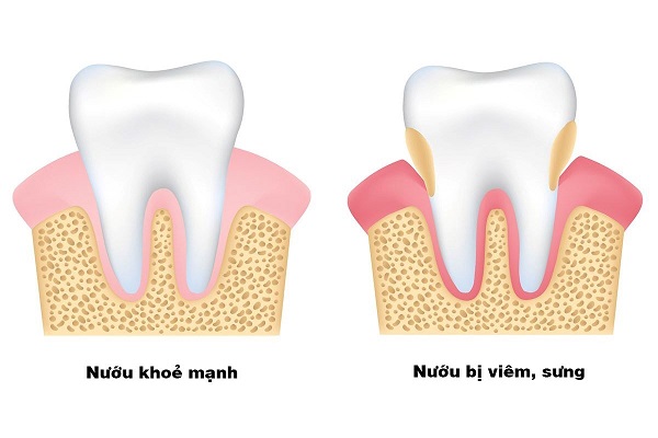 4 lý do hàng đầu cần kiểm tra sức khỏe răng miệng thường xuyên 4 lý do hàng đầu cần kiểm tra sức khỏe răng miệng thường xuyên