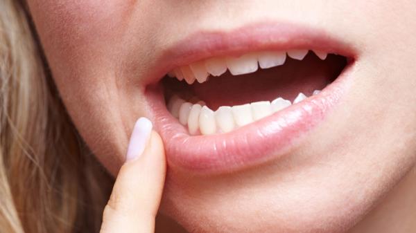 4 lý do hàng đầu cần kiểm tra sức khỏe răng miệng thường xuyên