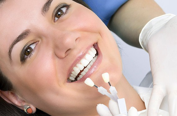 5 lợi ích của việc bọc răng sứ