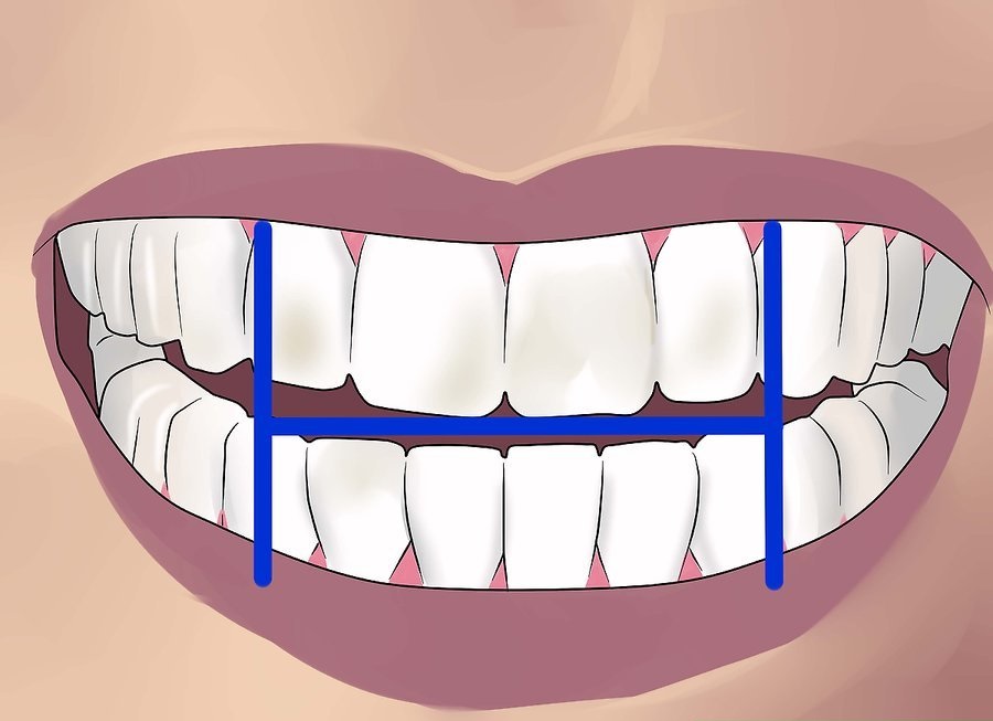 5 vấn đề sức khỏe răng miệng hàng đầu ở người cao tuổi