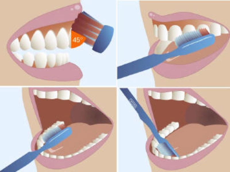 9 biện pháp loại bỏ vôi răng và mảng bám tại nhà hiệu quả nhất