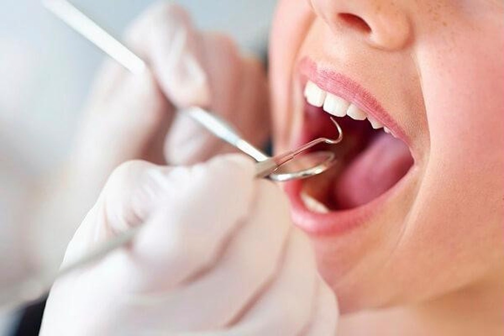 Bạn có biết lấy cao răng thường xuyên giúp răng khỏe mạnh hơn