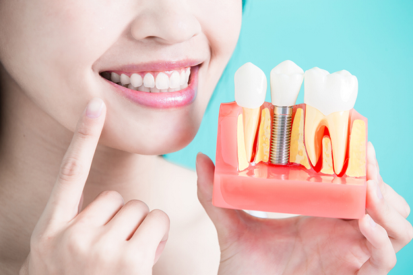 Bệnh viêm quanh implant ở bệnh nhân trồng răng implant