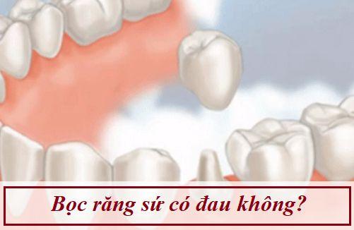 bọc răng sứ có đau không