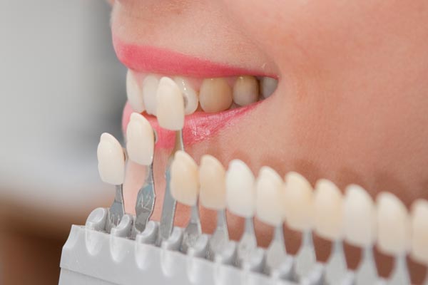 Bọc răng sứ và những vấn đề thường gặp Bọc răng sứ và những vấn đề thường gặp