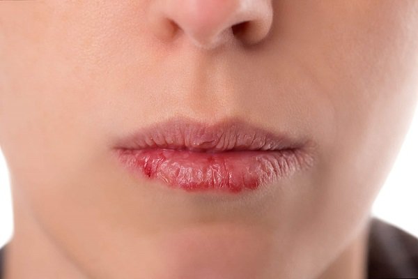 Các vấn đề răng miệng thường gặp nhất và cách khắc phục Các vấn đề răng miệng thường gặp nhất và cách khắc phục