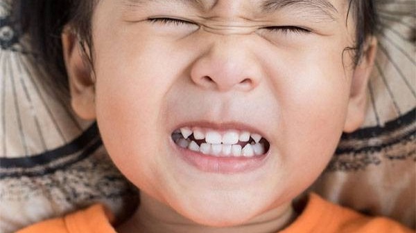 Các vấn đề sức khỏe răng miệng ở trẻ