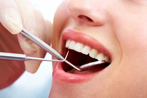 cách giải quyết tình trạng đe nướu do sứ kim loại