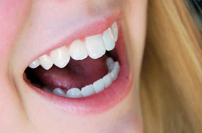 Cải thiện thẩm mỹ nụ cười bằng răng sứ Cercon cao cấp