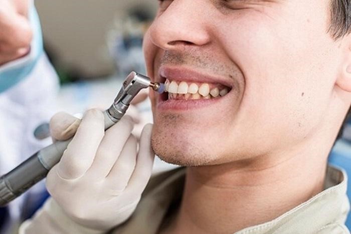 Cạo vôi răng tại tân phú Cạo vôi răng tại tân phú