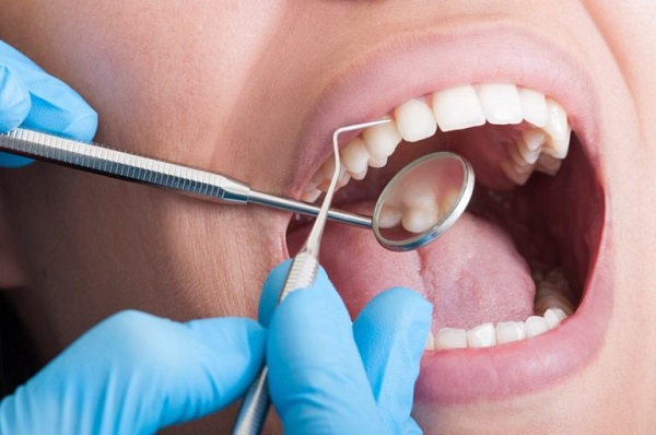 Cạo vôi răng tại quận 10 Cạo vôi răng tại quận 10