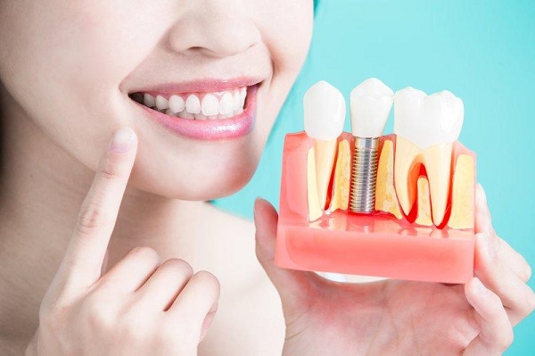 Có được uống rượu bia sau khi cấy ghép răng implant không