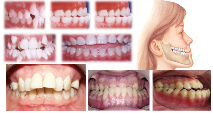 làm răng thẩm mỹ làm răng thẩm mỹ