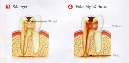 làm răng thẩm mỹ