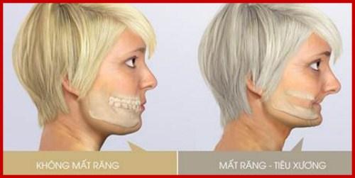 làm răng thẩm mỹ làm răng thẩm mỹ