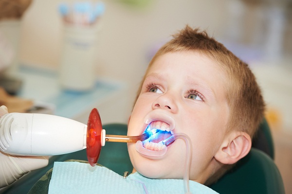 Có nên trám răng sữa sâu cho trẻ em hay không Có nên trám răng sữa sâu cho trẻ em hay không