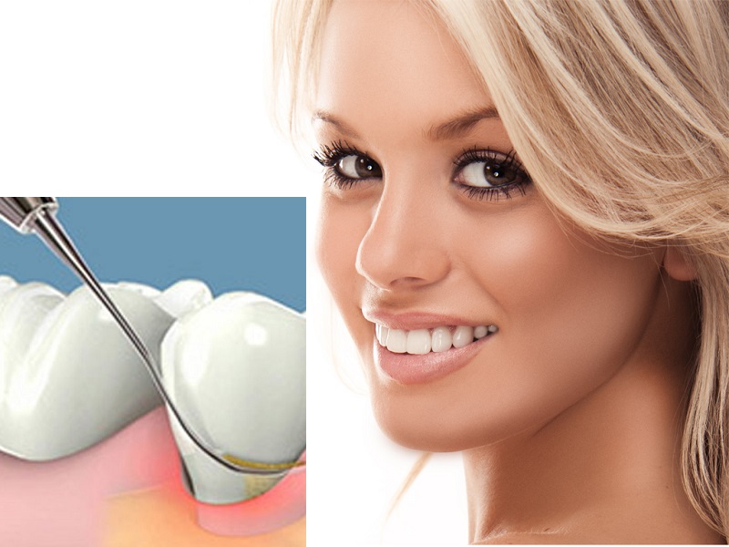 Công dụng không ngờ tới của quả chanh đối với răng miệng Công dụng không ngờ tới của quả chanh đối với răng miệng