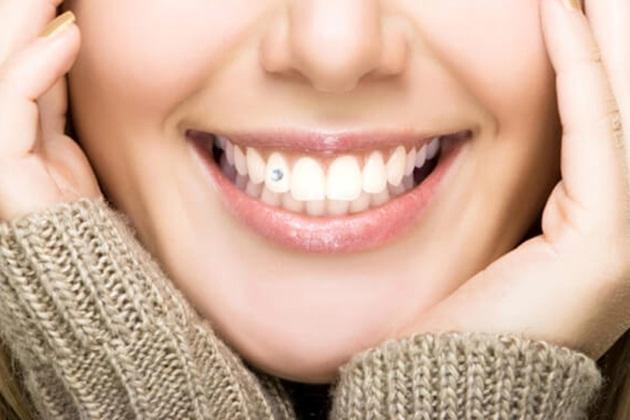 Đính đá thẩm mỹ Đính đá thẩm mỹ