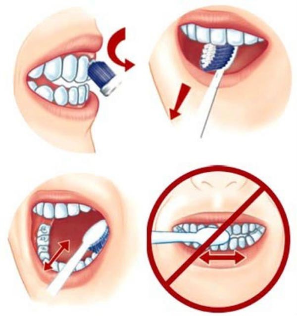 Đừng gây hại cho răng bạn bằng những thói quen xấu này Đừng gây hại cho răng bạn bằng những thói quen xấu này