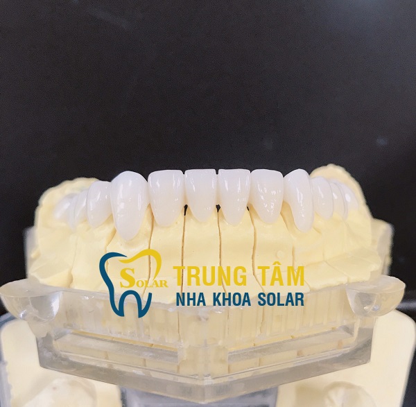 Hàm răng xỉn màu trở nên trắng sáng hoàn hảo nhờ bọc răng sứ Cercon HT