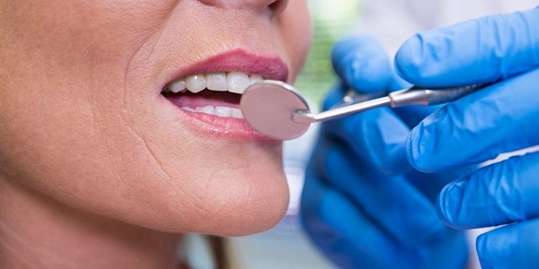 Làm đẹp với dịch vụ bọc răng sứ và trám răng thẩm mỹ Làm đẹp với dịch vụ bọc răng sứ và trám răng thẩm mỹ