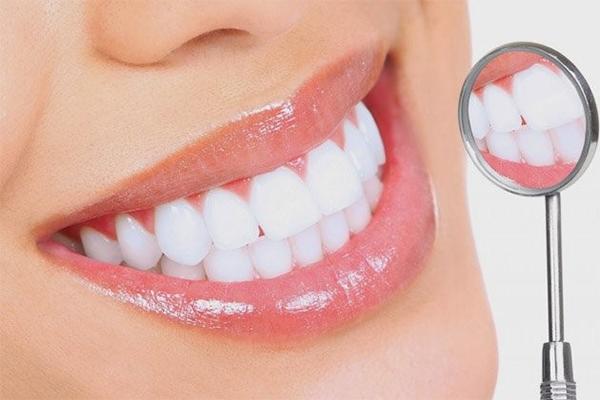 Làm sao để giữ bộ răng sứ trắng đẹp Làm sao để giữ bộ răng sứ trắng đẹp
