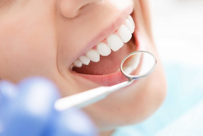 Làm thế nào để giảm thiểu rủi ro khi bọc răng sứ
