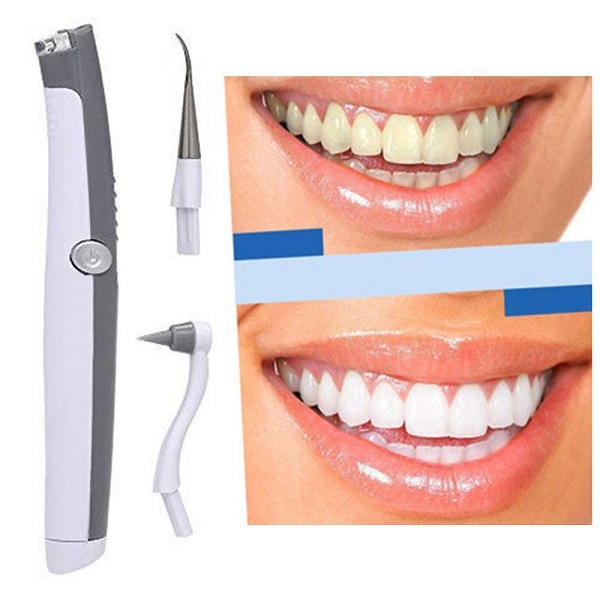 Làm thế nào để loại bỏ mảng bám và vôi răng Làm thế nào để loại bỏ mảng bám và vôi răng