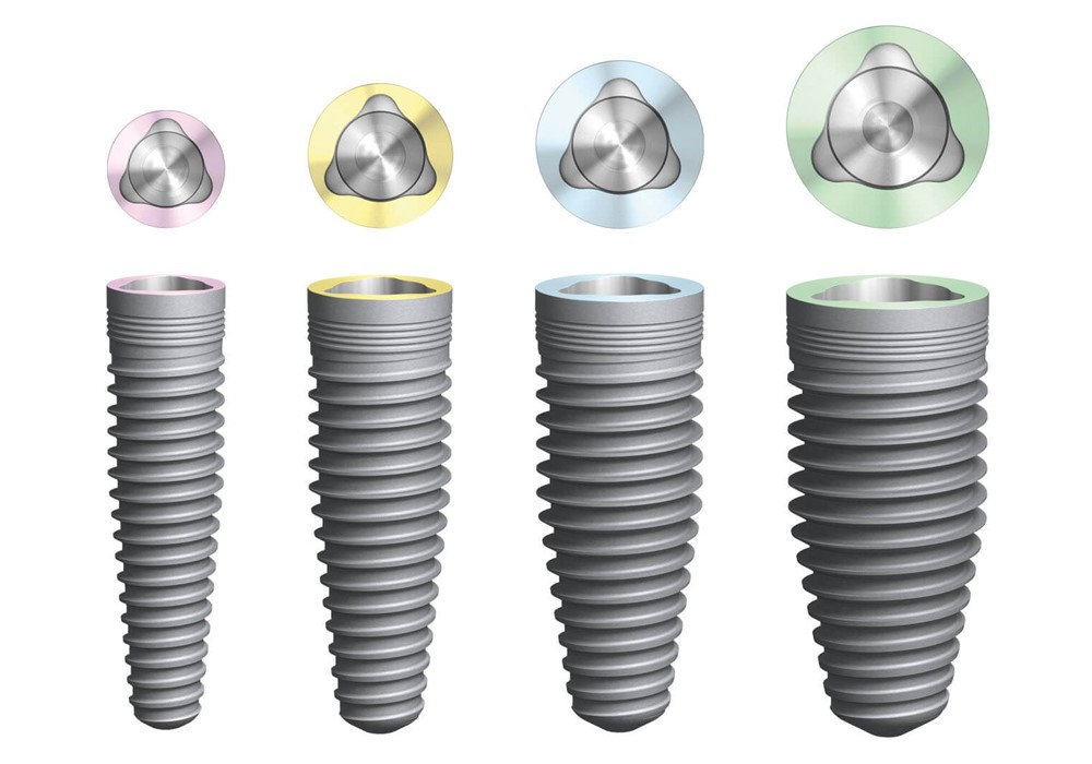 nên cấy ghép implant loại nào tốt 