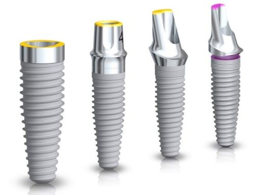 nên cấy ghép implant loại nào tốt 