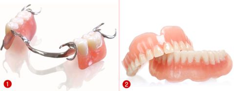 Nên hay không nên làm răng sứ tháo lắp Nên hay không nên làm răng sứ tháo lắp