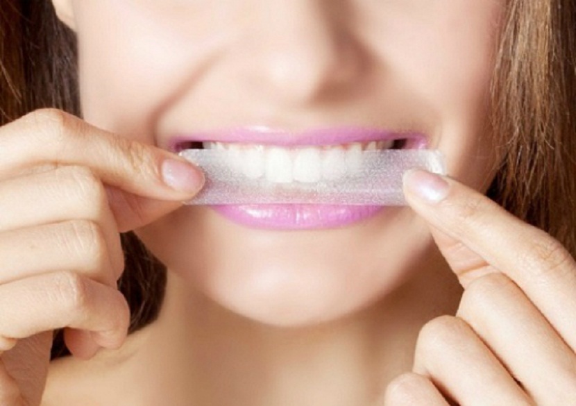 Nguy hại từ việc tẩy trắng răng giá rẻ không rõ nguồn gốc Nguy hại từ việc tẩy trắng răng giá rẻ không rõ nguồn gốc