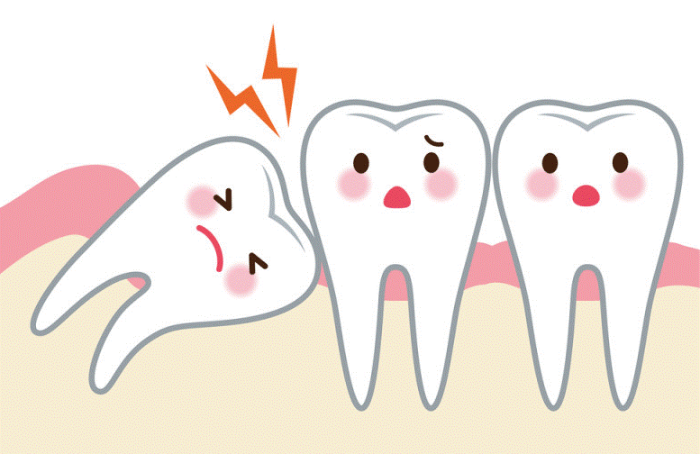 nhổ răng khôn ở phụ nữ mang thai nhổ răng khôn ở phụ nữ mang thai