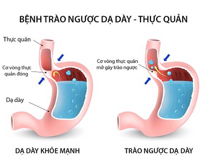 Những bệnh lý tìm ẩn thông qua vấn đề răng miệng