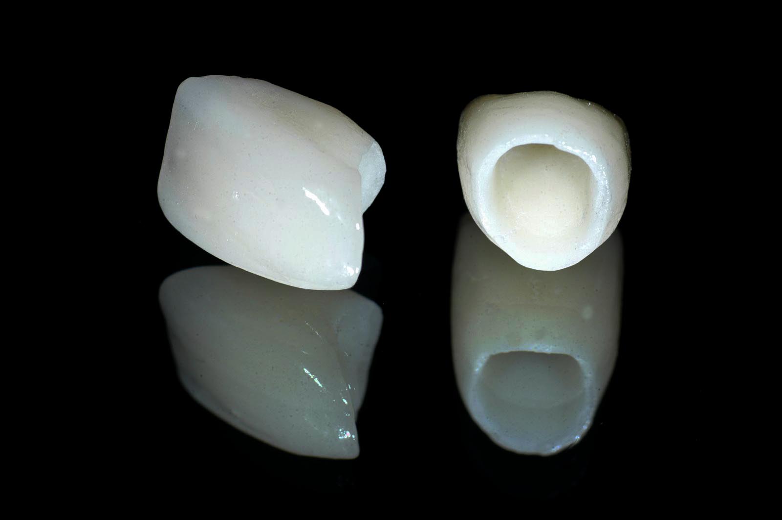 Những điều cần biết về bọc răng sứ Cercon HT