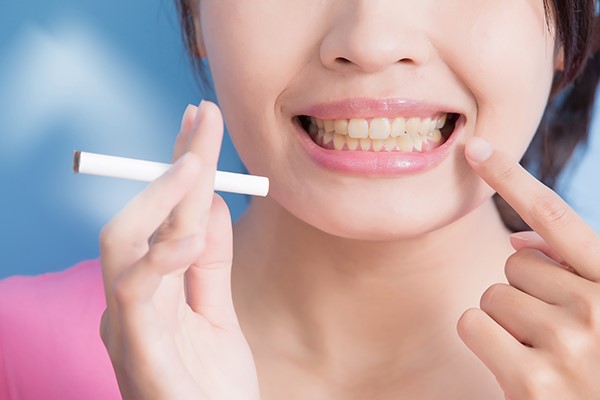 Những điều cần lưu ý sau khi cạo vôi răng Những điều cần lưu ý sau khi cạo vôi răng
