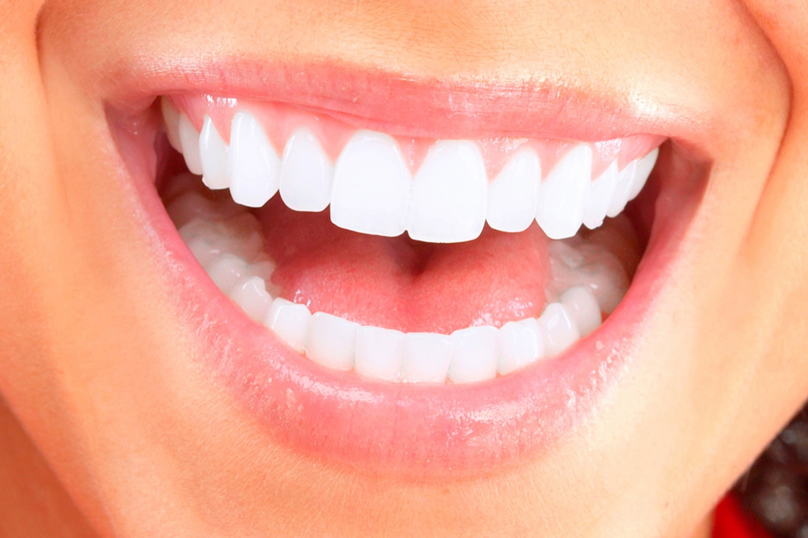 Những điều cần lưu ý sau khi cạo vôi răng Những điều cần lưu ý sau khi cạo vôi răng