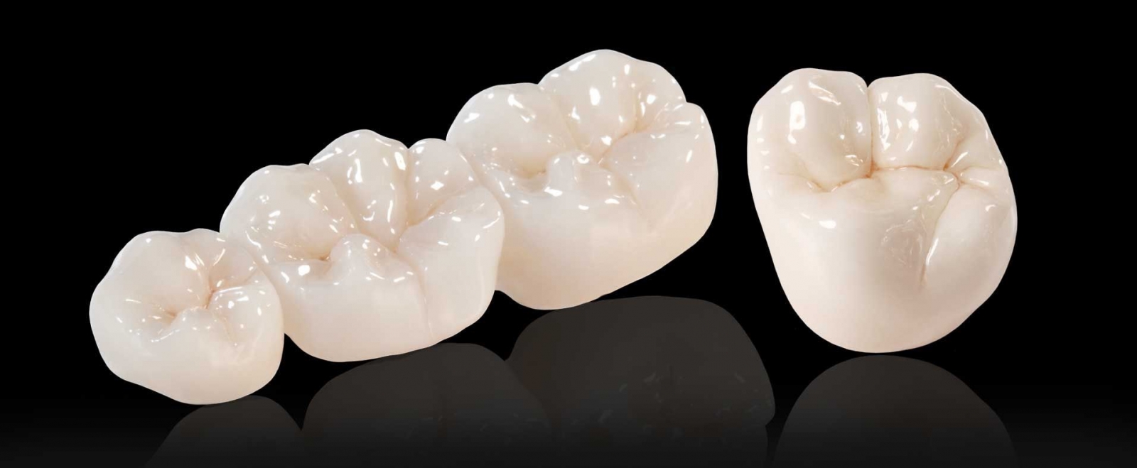 Những loại răng sứ tốt nhất hiện nay Những loại răng sứ tốt nhất hiện nay