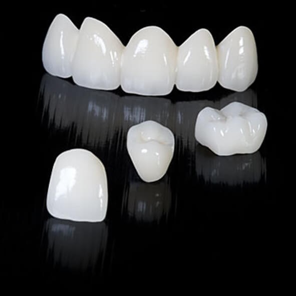 Những loại răng sứ tốt nhất hiện nay và ưu nhược của từng loại