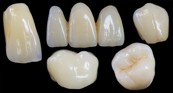 Những loại răng sứ tốt nhất hiện nay Những loại răng sứ tốt nhất hiện nay