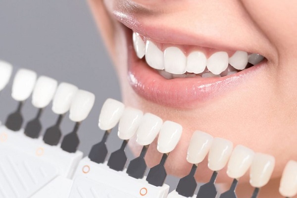 Những nguyên nhân khiến răng bị ố vàng Những nguyên nhân khiến răng bị ố vàng