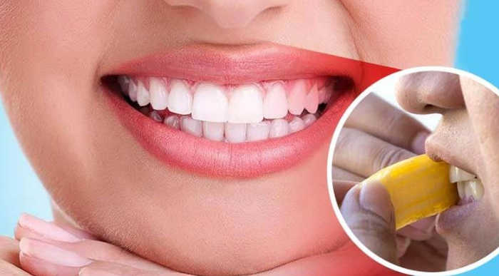 Những phương pháp tẩy trắng răng tại nhà có hiệu quả Những phương pháp tẩy trắng răng tại nhà có hiệu quả
