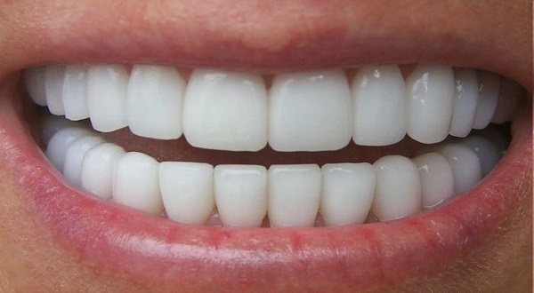 Những trường hợp không nên bọc răng sứ Những trường hợp không nên bọc răng sứ