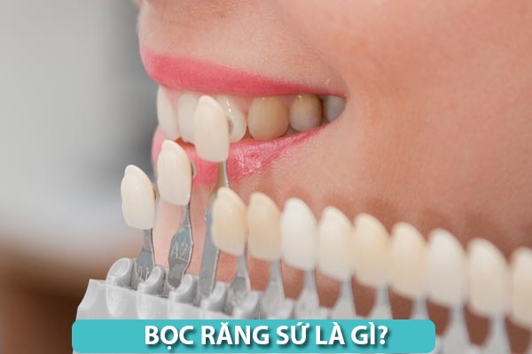 Những trường hợp không nên bọc răng sứ