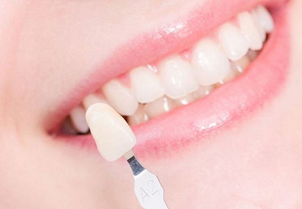 Những ưu điểm không ngờ từ phương pháp bọc răng sứ Những ưu điểm không ngờ từ phương pháp bọc răng sứ