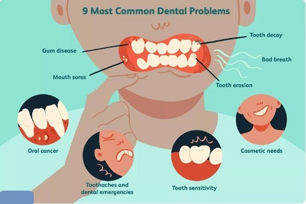 Những vấn đề nha khoa phổ biến hiện nay