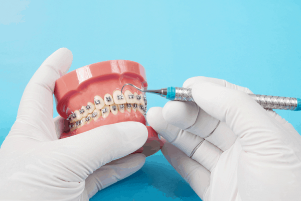Những vấn đề nha khoa phổ biến hiện nay Những vấn đề nha khoa phổ biến hiện nay
