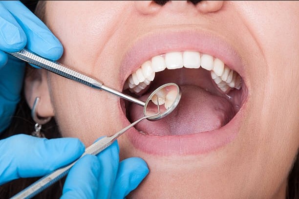 Niềng răng tại nha khoa tân phú